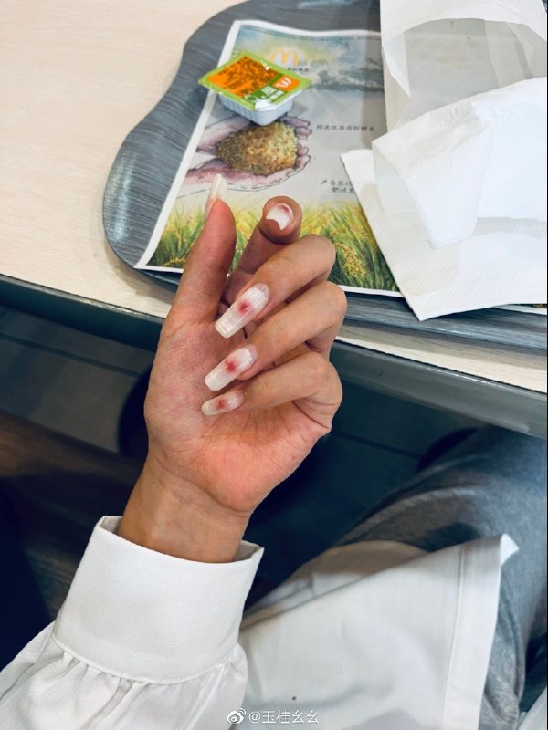 #珈乐魂 #微博评论 饱了指甲长这样被评论的微博 三松许玉桂幺幺 有次带小虎帽在发呆突然有一只手把口罩给我扒到下巴然后我就拍下了对方的“作案”手段引号 1. 表示引用